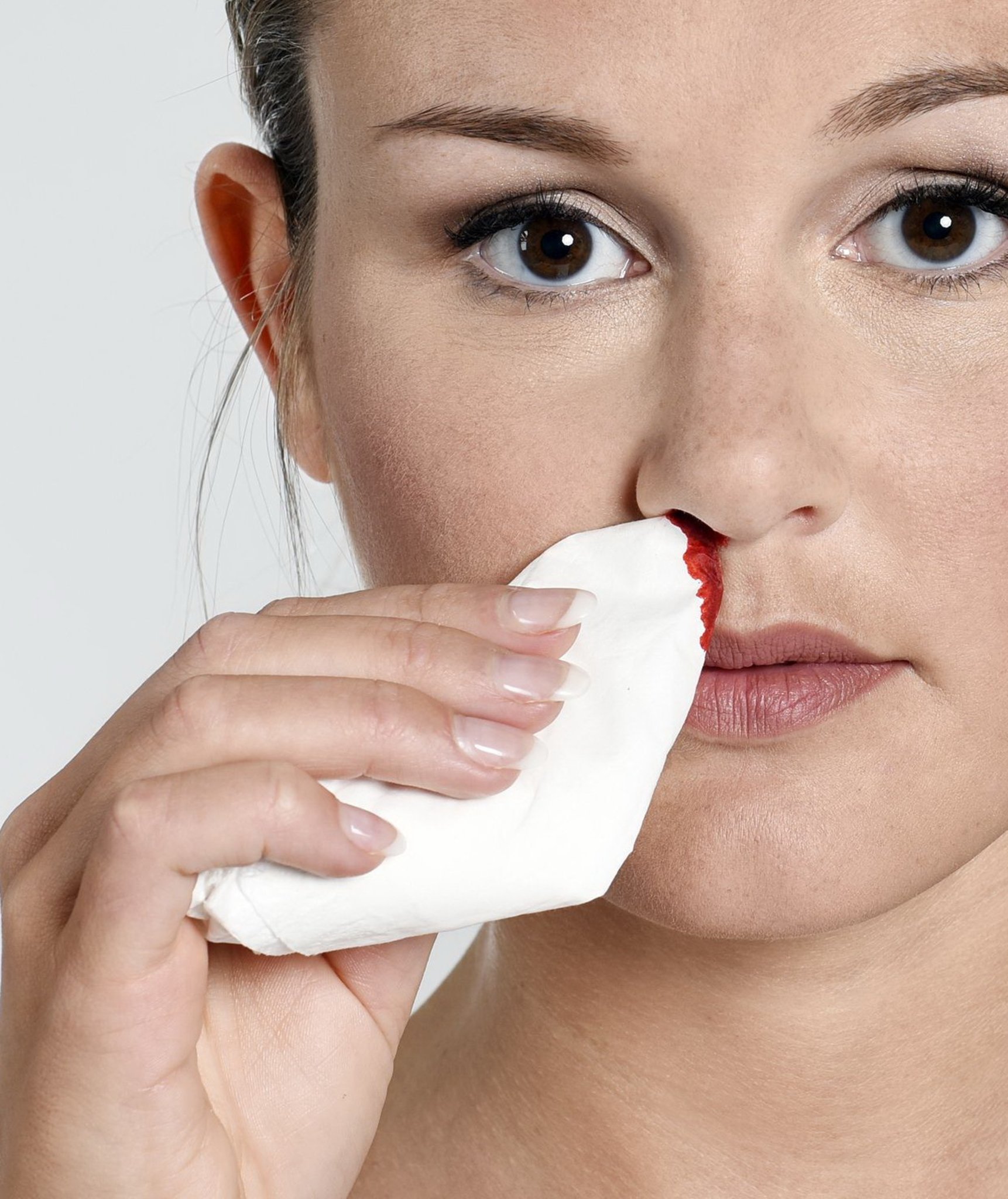 Blutgerinnungsstörung: Erkennen heißt beherrschen - Bretten