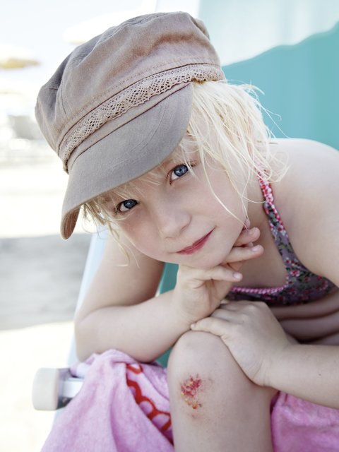 Auch auf frische Wunden läßt sich das kühlende, hydroaktive Wundgel problemlos aufbringen. | Foto: Karin & Uwe Annas/stock.adobe.com